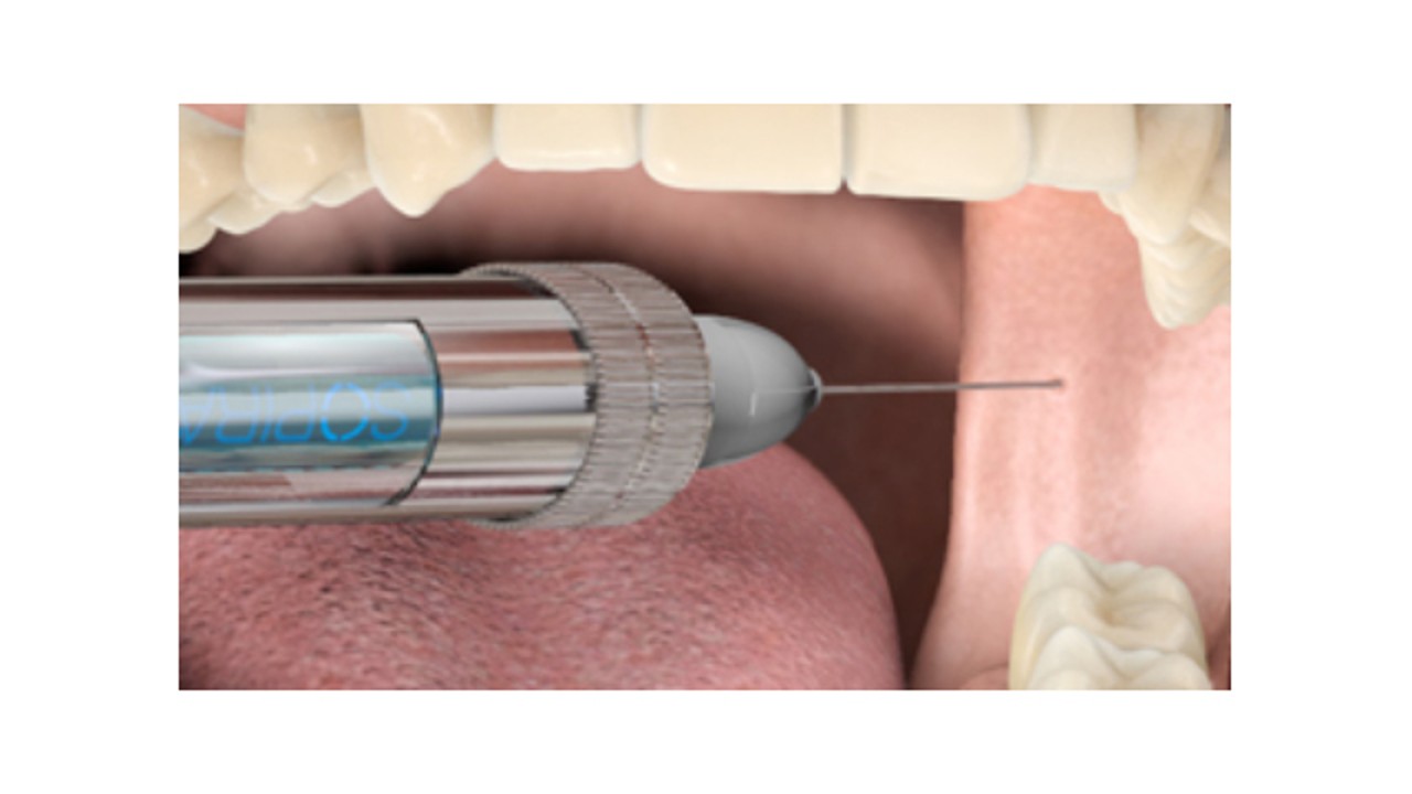 Anestesia Infiltrativa